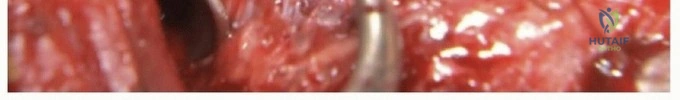 Clinical Image