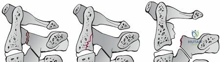 Clinical Image