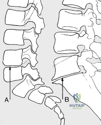 Clinical Image