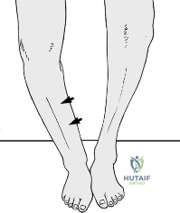 Clinical Image