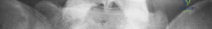 Clinical Image