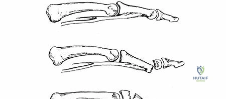 Clinical Image