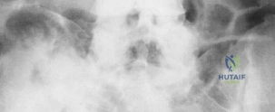 Clinical Image