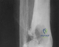 Clinical Image