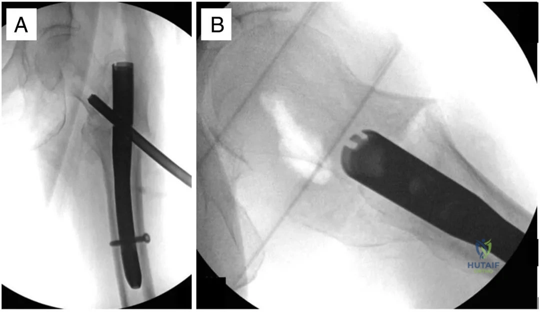 Clinical Image