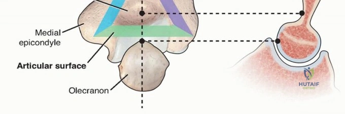Clinical Image