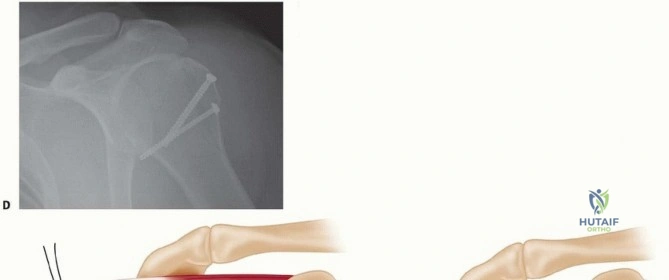 Clinical Image