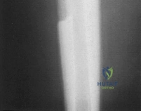 Clinical Image