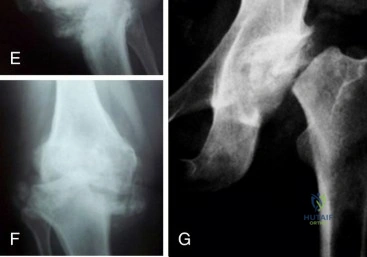 Clinical Image