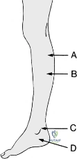 Clinical Image