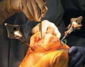 Clinical Image