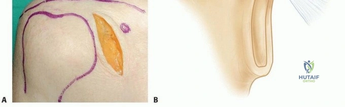 Clinical Image
