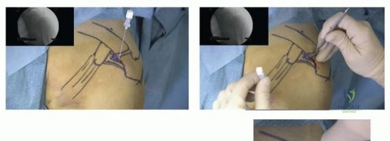 Clinical Image