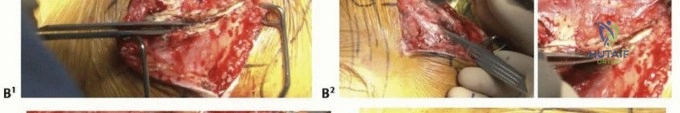 Clinical Image
