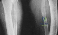 Clinical Image