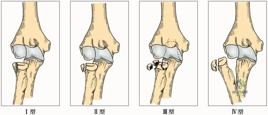 Clinical Image