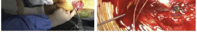 Clinical Image