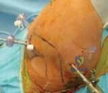 Clinical Image