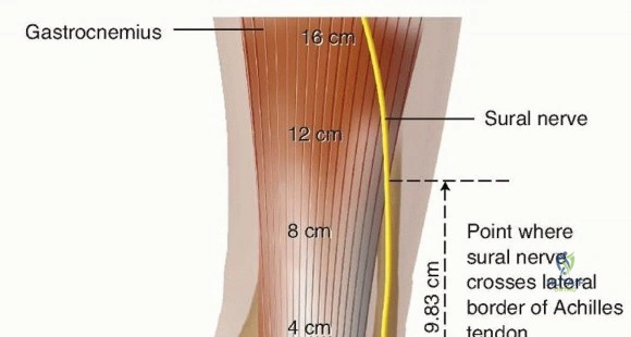 Clinical Image