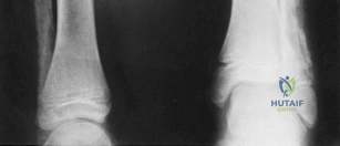 Clinical Image