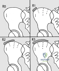 Clinical Image