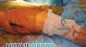 Clinical Image