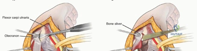 Clinical Image
