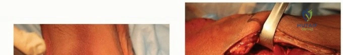 Clinical Image