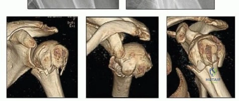 Clinical Image