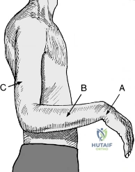 Clinical Image