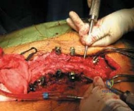 Clinical Image