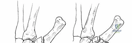 Clinical Image