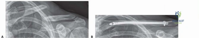 Clinical Image