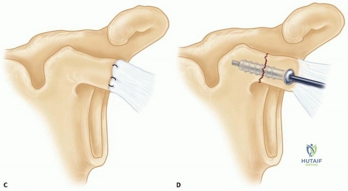 Clinical Image