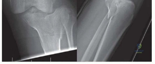 Clinical Image
