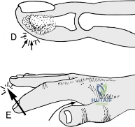 Clinical Image