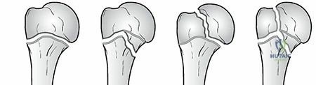 Clinical Image