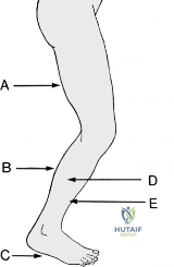 Clinical Image