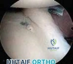 Clinical Image