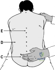 Clinical Image