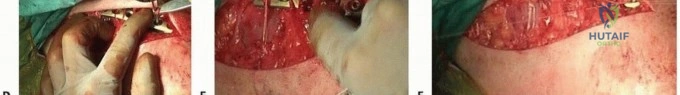 Clinical Image