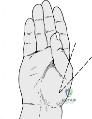 Clinical Image