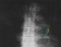 Clinical Image