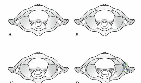 Clinical Image