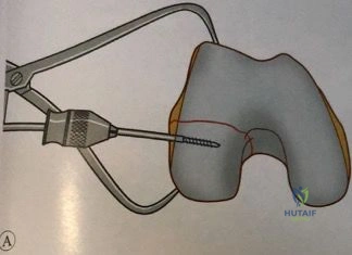 Clinical Image