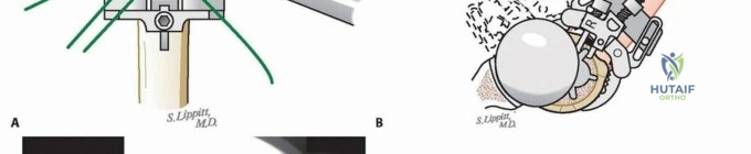 Clinical Image