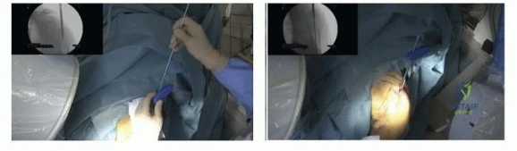 Clinical Image