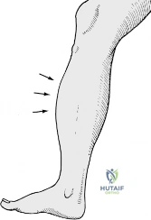 Clinical Image