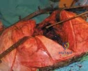 Clinical Image
