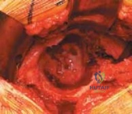 Clinical Image